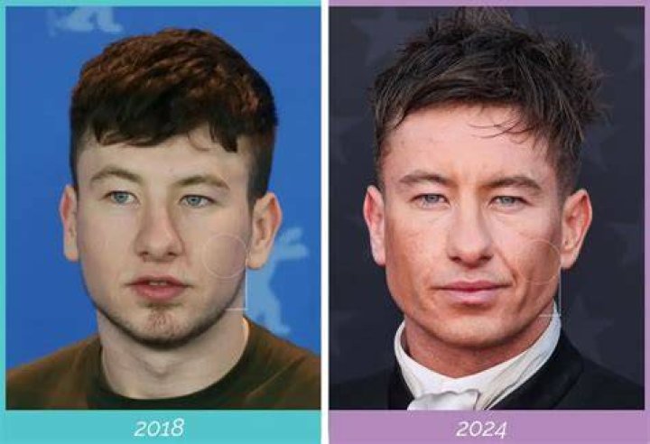 Barry Keoghan: From Obscurity To Hollywood Star