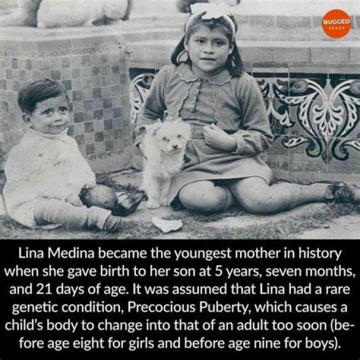 Lina Medina: The Youngest Mother In History