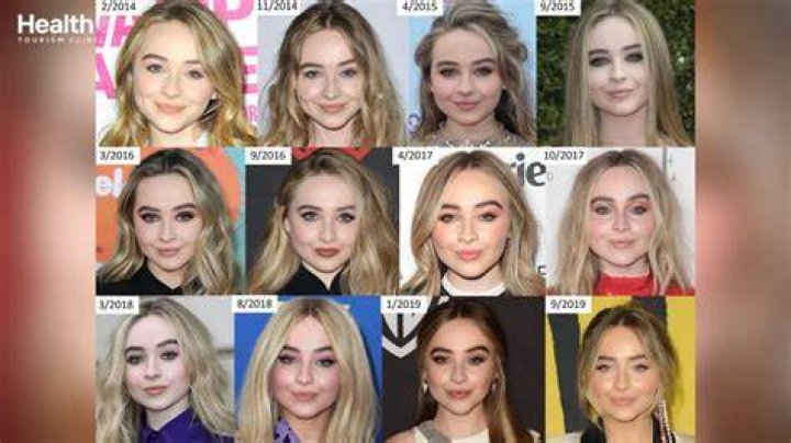 The Ultimate Guide To Sabrina Carpenter's Cosmetic Procedures