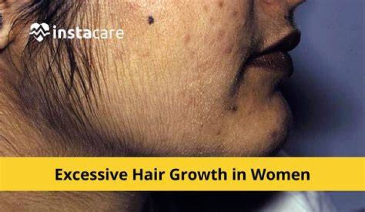 Understanding Excess Hair Growth On Women's Backs