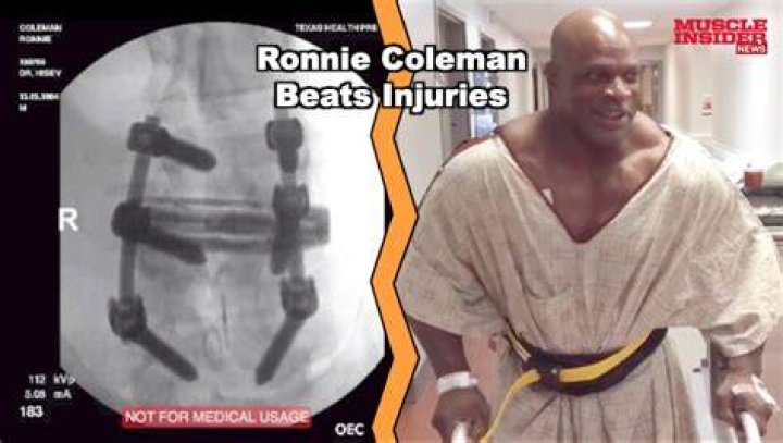 Unraveling The Journey Of Ronnie Coleman: Triumphs And Injuries
