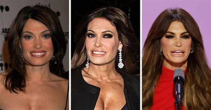 Unveiling Kimberly Guilfoyle: The Truth Behind Her Plastic Surgery Journey