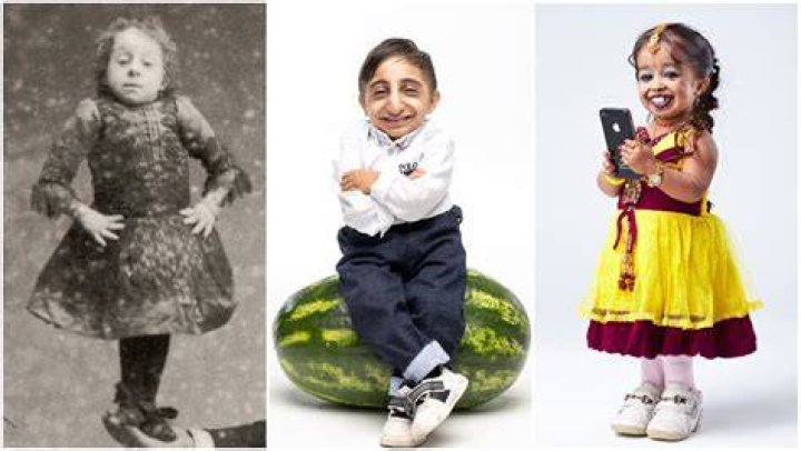 Unveiling The World's Tiniest Wonder: The Remarkable Story Of The World's Smallest Woman